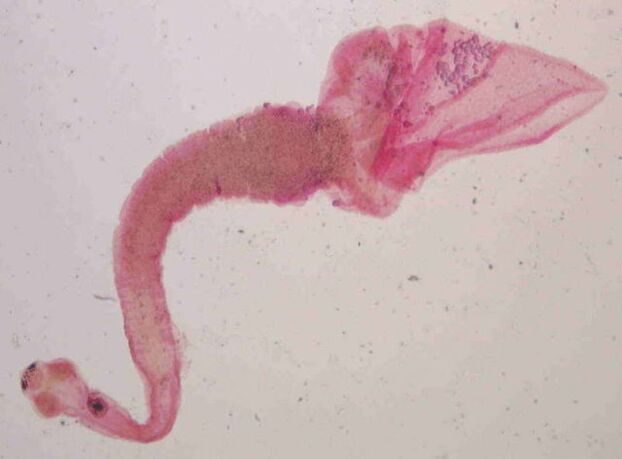 svinjska trakulja iz človeškega telesa