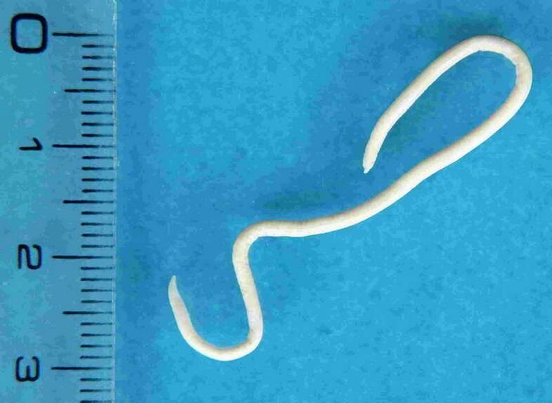 črv iz človeškega telesa