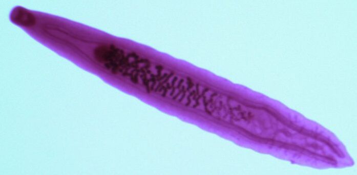 metilj parazit iz človeškega telesa