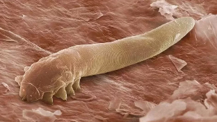 Paraziti v človeškem telesu