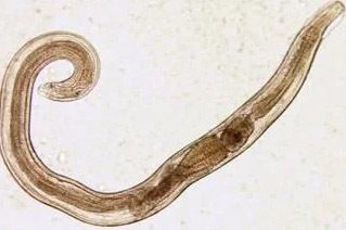 človekove paraziti pinworm